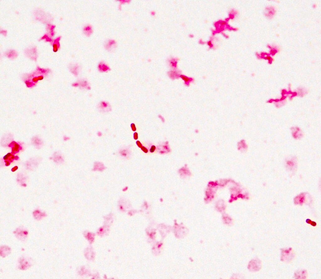 Klebsiella oxytoca: un brote de bacteria deja 13 muertos en Edomex