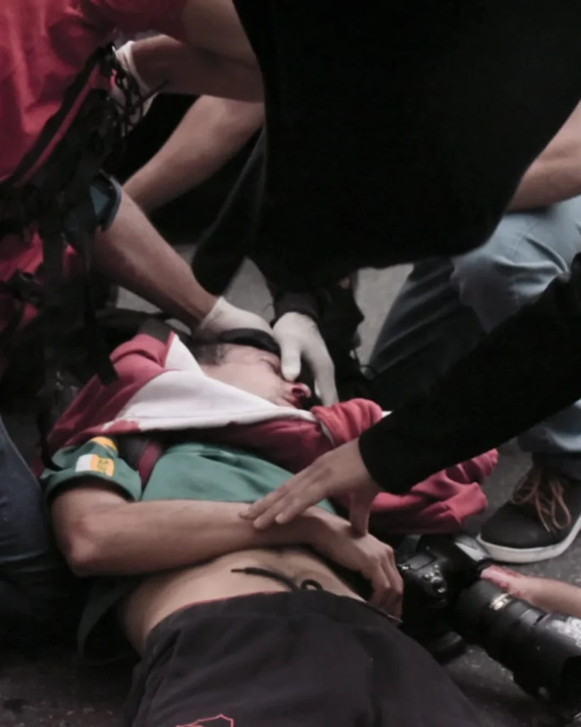 Argentina: el fotoperiodista Pablo Grillo, herido de gravedad tras represión en protestas de jubilados