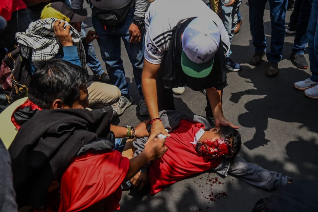 Tras represión en Cdmx, maestro de la CNTE corre riesgo de perder su ojo Tras represión en Cdmx, maestro de la CNTE corre riesgo de perder su ojo