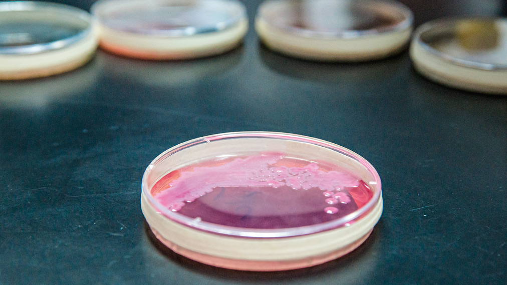 UNAM patenta proceso para limpiar metales pesados a través de una bacteria