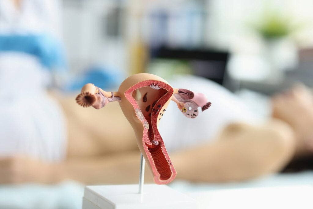 Endometriosis: cuando controlar las hormonas no basta para frenar el dolor Endometriosis: cuando controlar las hormonas no basta para frenar el dolor